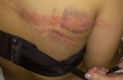 Adolescente levou golpe de cassetete durante ação da polícia em baile funk