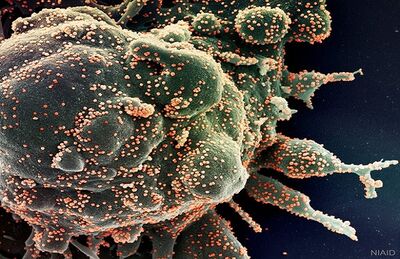 Foto microscópica mostra célula humana sendo infectada pelo Sars Cov-2, o novo coronavírus