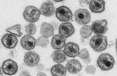 Células do vírus HIV (viriões), em imagem microscópica produzida em 2011