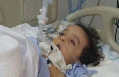 Uma radiografia apontou um bloqueio das vias aéreas em um dos pulmões do menino