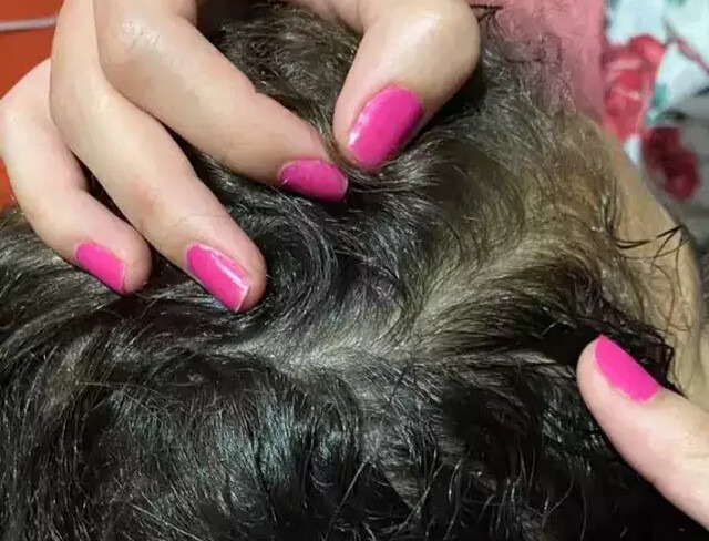 Mãe olhando cabeça da criança. Foto: Reprodução
