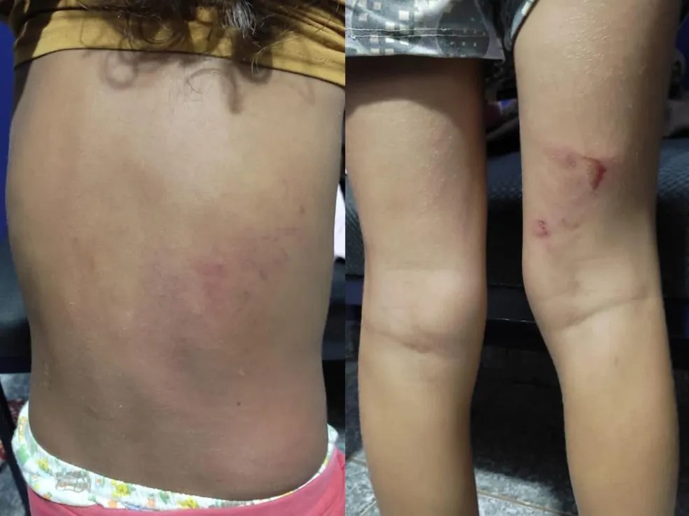 Crianças tinham várias marcas de agressões pelo corpo. Foto: Reprodução