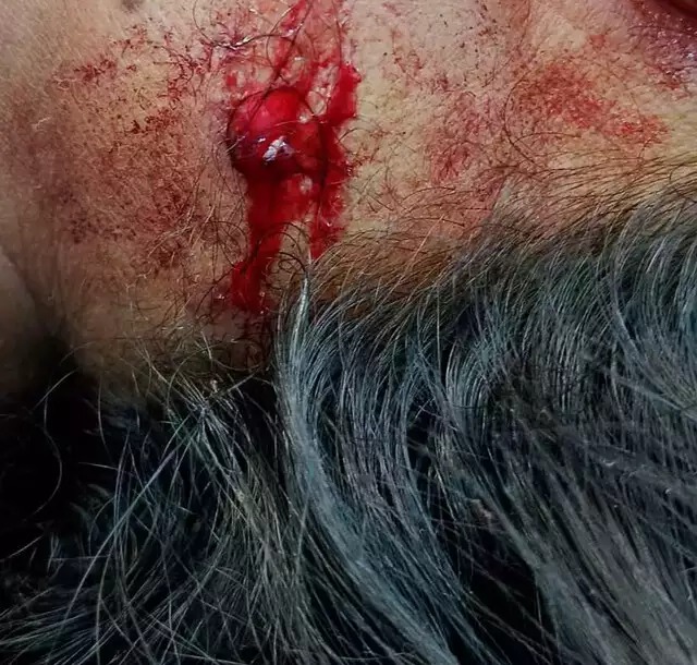 Vítima foi baleada de raspão no pescoço. Foto: Rede social