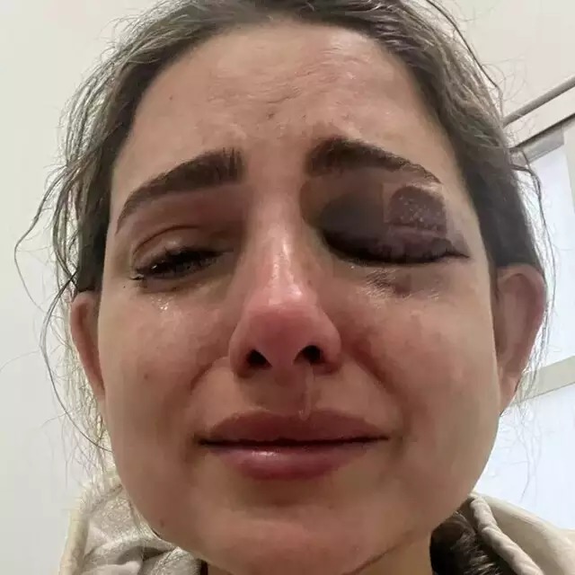 Abalada, vítima chora ao buscar atendimento médico. Foto: Arquivo pessoal