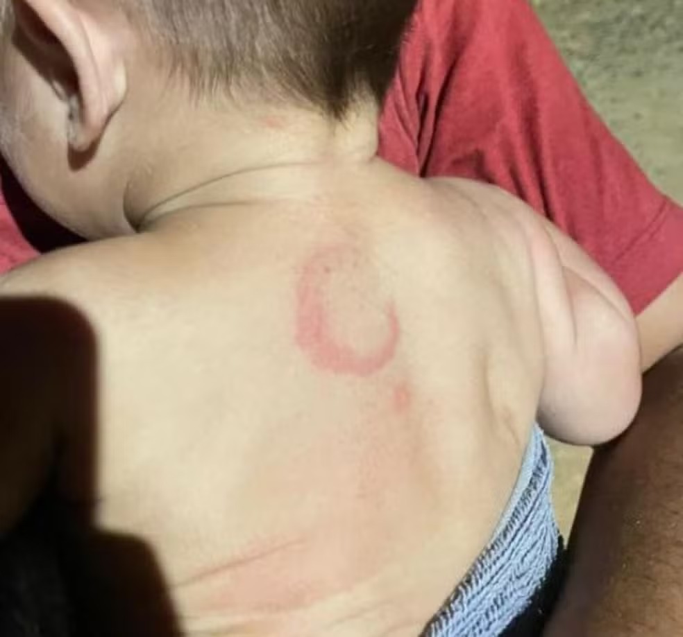 O bebê de 4 meses, está internado na Santa Casa de Campo Grande. Foto: Reprodução